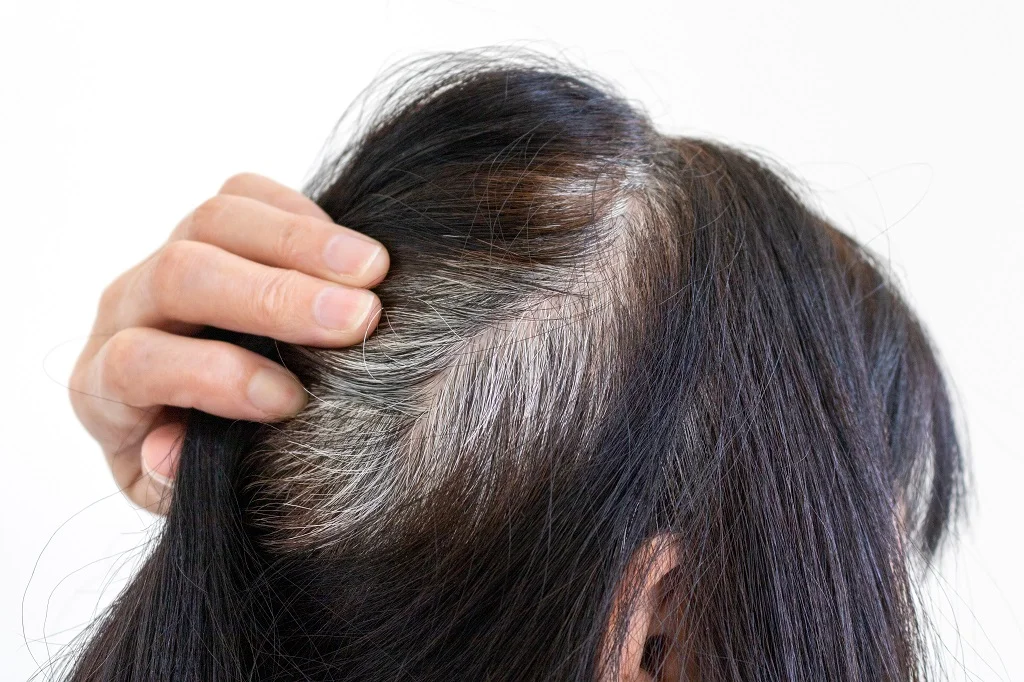 wellhealthorganic.com/know-the-causes-of-white-hair-and-easy-ways-to-prevent-it-naturally